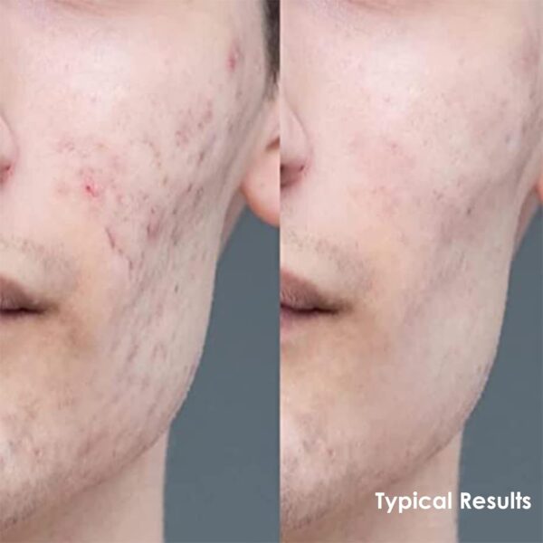 Apricus Skincare Tinted Moisturizer