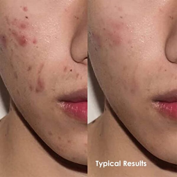 Apricus Skincare Tinted Moisturizer